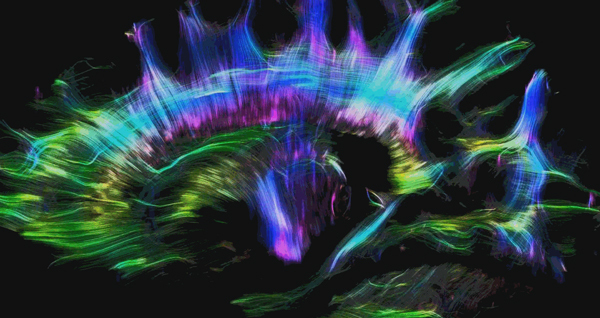 Tractography Web